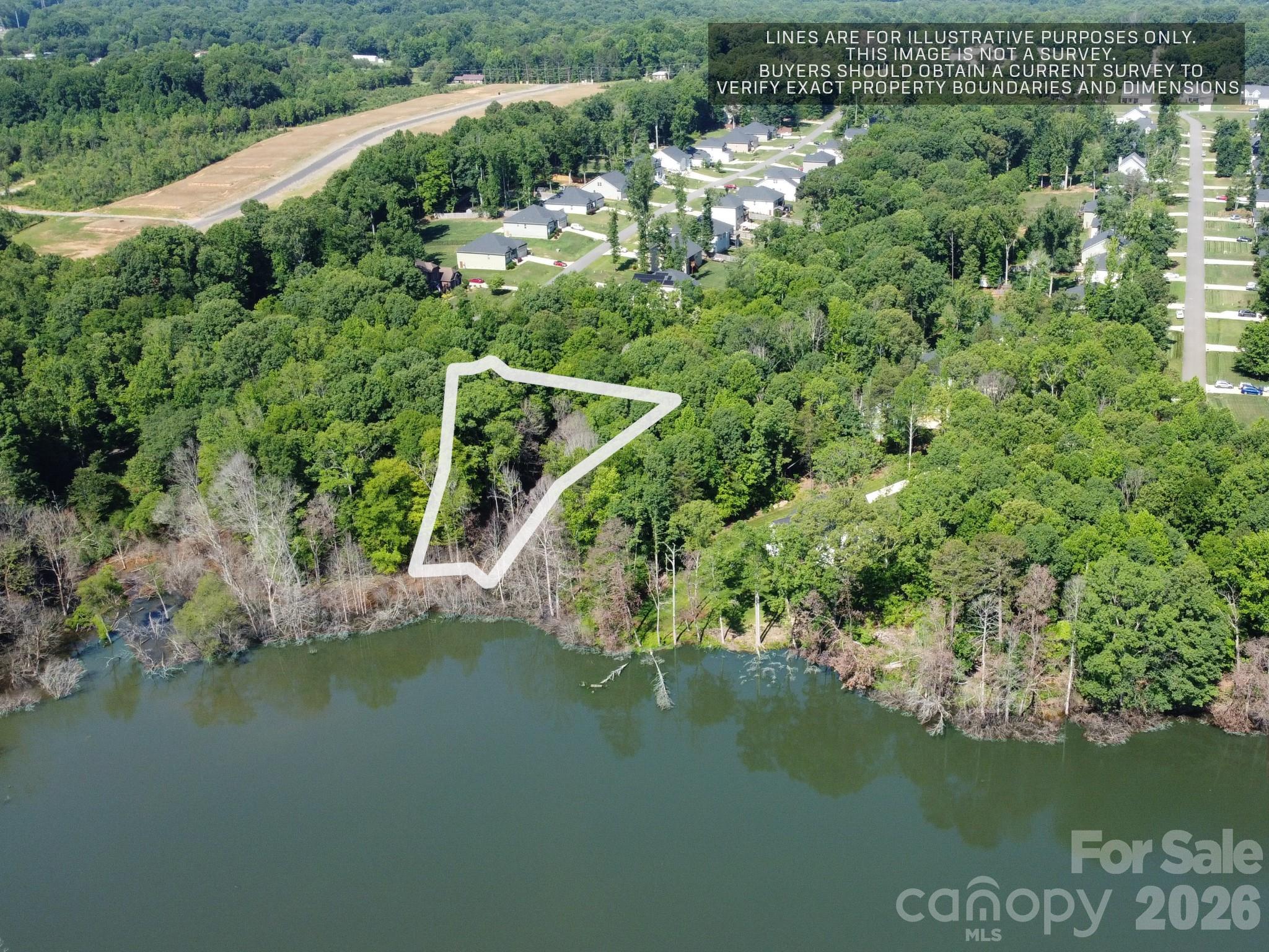 175 Northlake Drive